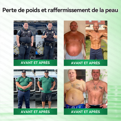 𝑩𝒐𝒖𝒕𝒊𝒒𝒖𝒆 𝒐𝒇𝒇𝒊𝒄𝒊𝒆𝒍𝒍𝒆 |🍃🫧𝐆𝐋𝗢𝗥𝗘𝗡𝗗𝑨®𝑴𝒐𝒓𝒊𝐧𝐠𝙖 · 𝘽𝙚𝙧𝙗é𝙧𝒊𝒏𝒆 ×𝐍𝘼𝗗+ 𝟭0-𝒆𝒏-𝟏 𝐏𝐚𝙩𝙘𝙝 𝙈𝙞𝙘𝙧𝙤𝙣é𝙚𝒅𝒍𝒆 𝑨𝒗𝒂𝐧𝐜é 𝙉𝙖𝒏𝒐🇫🇷(𝐔𝐧𝐞 𝐬𝐞𝐮𝐥𝐞 𝐟𝐨𝐢𝐬 𝐩𝐚𝐫 𝐣𝐨𝐮𝐫, 𝐜𝐡𝐚𝐧𝐠𝐞𝐦𝐞𝐧𝐭𝐬 𝐯𝐢𝐬𝐢𝐛𝐥𝐞𝐬 𝐞𝐧 𝟕 𝐣𝐨𝐮𝐫𝐬） ✅ 𝐏𝐨𝐮𝐫 𝐥’𝐨𝐛é𝐬𝐢𝐭é, 🅟🅔🅐🅤 🅡🅔🅛â🅒🅗é🅔,𝐝𝐢𝐚𝐛è𝐭𝐞, 𝐚𝐩𝐧é𝐞 𝐝𝐮 𝐬𝐨𝐦𝐦𝐞𝐢𝐥, 𝐩𝐫𝐨𝐛𝐥è𝐦𝐞𝐬 𝐚𝐫𝐭𝐢𝐜𝐮𝐥𝐚𝐢𝐫𝐞𝐬, 𝐞𝐭 𝐛𝐢𝐞𝐧 𝐩𝐥𝐮𝐬